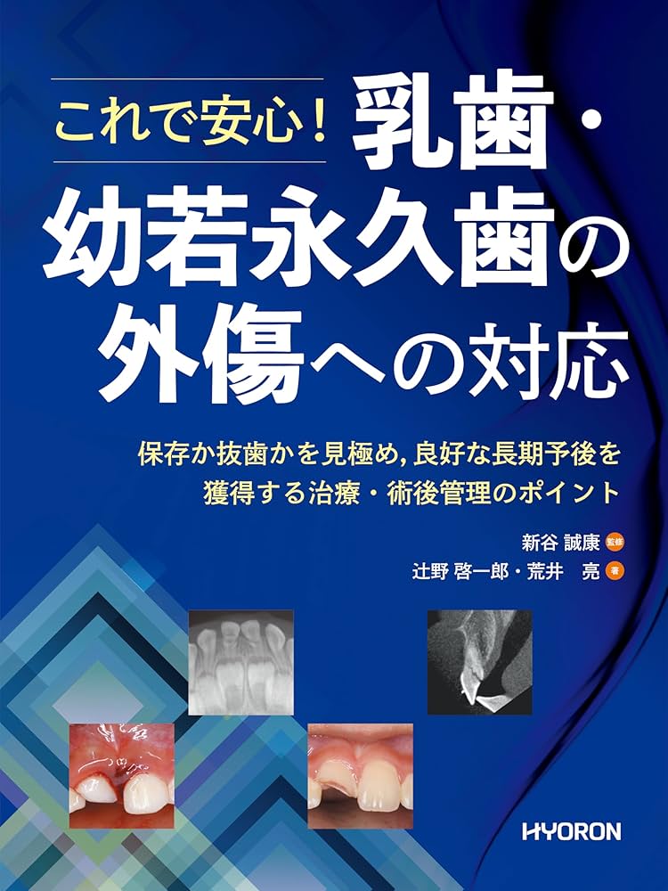 外傷歯の診断と治療【裁断済】 外傷歯の診断と治療【裁断済】 Amazon.co.jp: 外傷歯の診断と